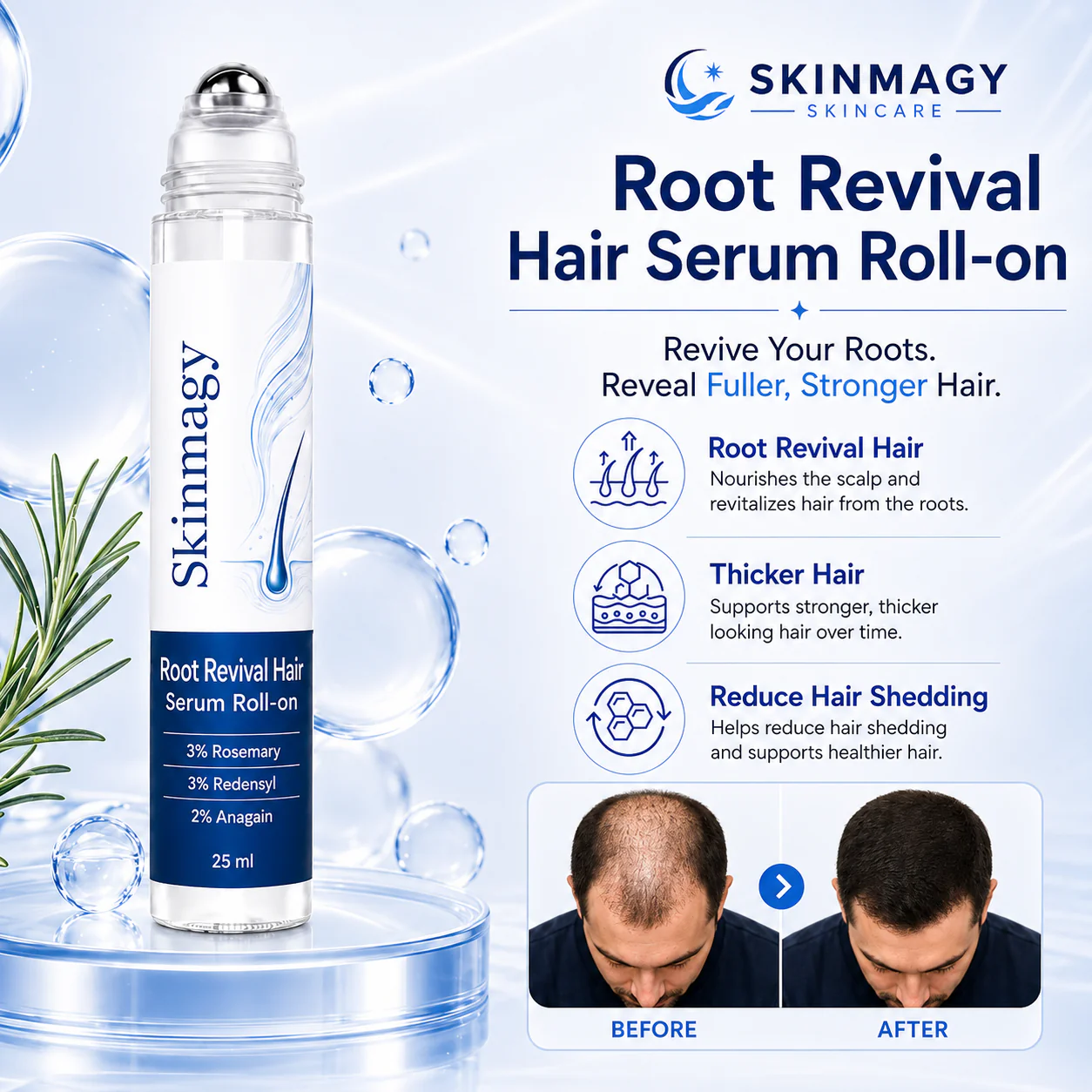 SKINMAGY™ Root Revival Hair Roll On Serum